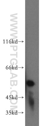 ALDH1A1 Antibody in Western Blot (WB)