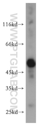 ALDH1A1 Antibody in Western Blot (WB)