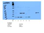 AMACR/p504S Antibody in Western Blot (WB)