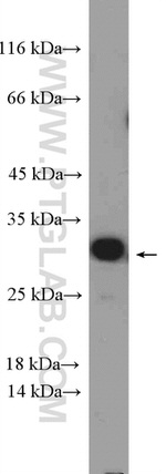 EXOSC4 Antibody in Western Blot (WB)