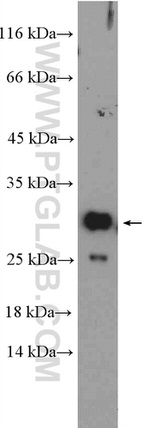 EXOSC4 Antibody in Western Blot (WB)