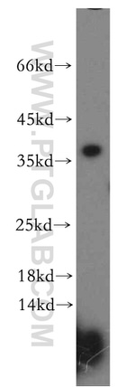 MED4 Antibody in Western Blot (WB)