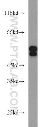 SH2D4A Antibody in Western Blot (WB)