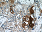 Elafin/Skalp Antibody in Immunohistochemistry (Paraffin) (IHC (P))