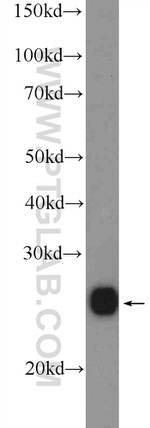 BNIP1 Antibody in Western Blot (WB)