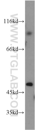 BHMT Antibody in Western Blot (WB)