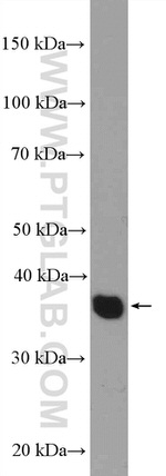 EBP2 Antibody in Western Blot (WB)