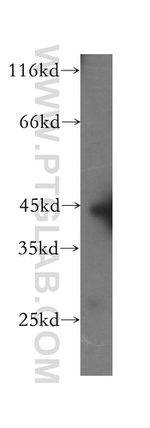 GTF2H2 Antibody in Western Blot (WB)