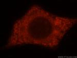 TXNDC4 Antibody in Immunocytochemistry (ICC/IF)