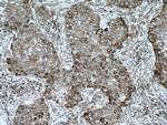 TXNDC4 Antibody in Immunohistochemistry (Paraffin) (IHC (P))