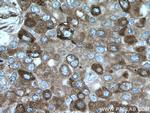 TXNDC4 Antibody in Immunohistochemistry (Paraffin) (IHC (P))