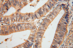 SERPINB2 Antibody in Immunohistochemistry (Paraffin) (IHC (P))