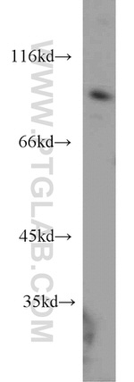 NOL9 Antibody in Western Blot (WB)