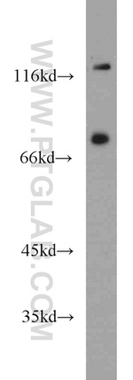 NOL9 Antibody in Western Blot (WB)