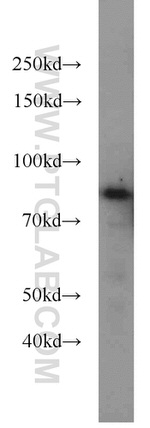 NOL9 Antibody in Western Blot (WB)