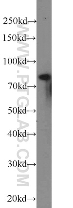 NOL9 Antibody in Western Blot (WB)