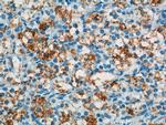 PELI2 Antibody in Immunohistochemistry (Paraffin) (IHC (P))