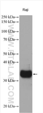 HLA-DPA1 Antibody in Western Blot (WB)