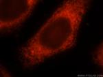 LPCAT1 Antibody in Immunocytochemistry (ICC/IF)