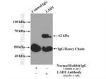 LAD1 Antibody in Immunoprecipitation (IP)