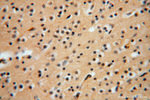 ATP6V1G1 Antibody in Immunohistochemistry (Paraffin) (IHC (P))