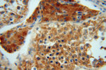 ATP6V1G1 Antibody in Immunohistochemistry (Paraffin) (IHC (P))