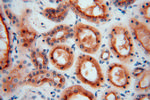 ATP6V1G1 Antibody in Immunohistochemistry (Paraffin) (IHC (P))