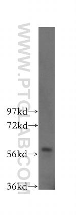 TOE1 Antibody in Western Blot (WB)