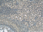 MKS1 Antibody in Immunohistochemistry (Paraffin) (IHC (P))