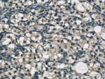 MKS1 Antibody in Immunohistochemistry (Paraffin) (IHC (P))