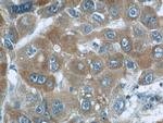 MKS1 Antibody in Immunohistochemistry (Paraffin) (IHC (P))