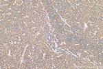 MKS1 Antibody in Immunohistochemistry (Paraffin) (IHC (P))