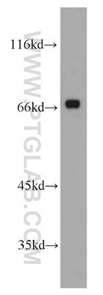 MKS1 Antibody in Western Blot (WB)