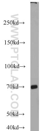 MKS1 Antibody in Western Blot (WB)