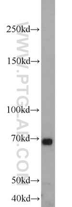 MKS1 Antibody in Western Blot (WB)