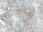 MAP3K6 Antibody in Immunohistochemistry (Paraffin) (IHC (P))