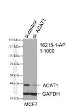 ACAT1 Antibody in Western Blot (WB)