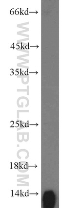 HBB Antibody in Western Blot (WB)