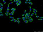 PDGFRL Antibody in Immunocytochemistry (ICC/IF)