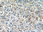 PDGFRL Antibody in Immunohistochemistry (Paraffin) (IHC (P))