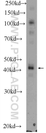 PDGFRL Antibody in Western Blot (WB)