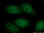 NUP54 Antibody in Immunocytochemistry (ICC/IF)