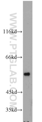 FAF2 Antibody in Western Blot (WB)