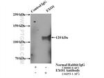 EXO1 Antibody in Immunoprecipitation (IP)