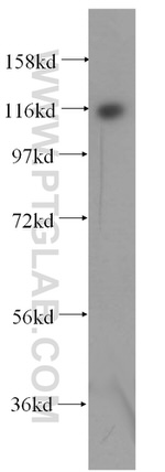 EXO1 Antibody in Western Blot (WB)