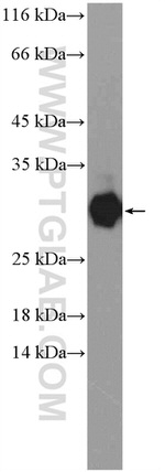 TSR2 Antibody in Western Blot (WB)