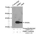 PQBP1 Antibody in Immunoprecipitation (IP)