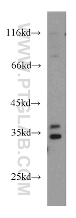 PQBP1 Antibody in Western Blot (WB)