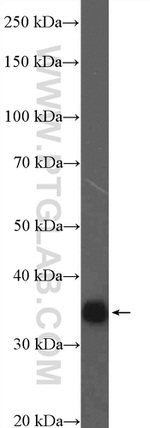 PQBP1 Antibody in Western Blot (WB)