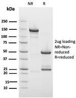 Drebrin 1 (DBN1) Antibody in SDS-PAGE (SDS-PAGE)